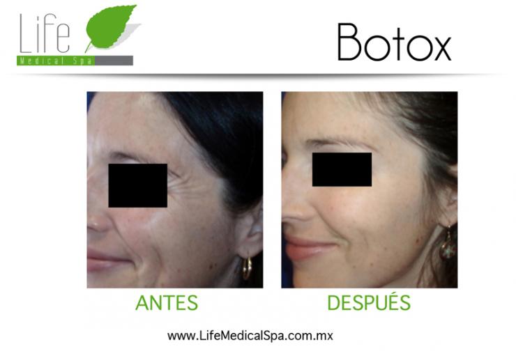 Clínica de belleza en guadalajara "life medical spa" en Guadalajara