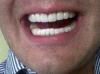 Clinica dental liser-odontlogos