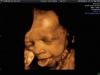 Foto de Diagnostico en ginecoobstetricia-embarazo de alto riesgo