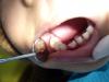 Cirujano Dentista Dra. Anita Sanchez